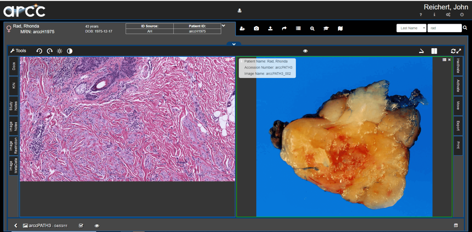 Apollo's Roots in Digital Pathology Enterprise Imaging Manage